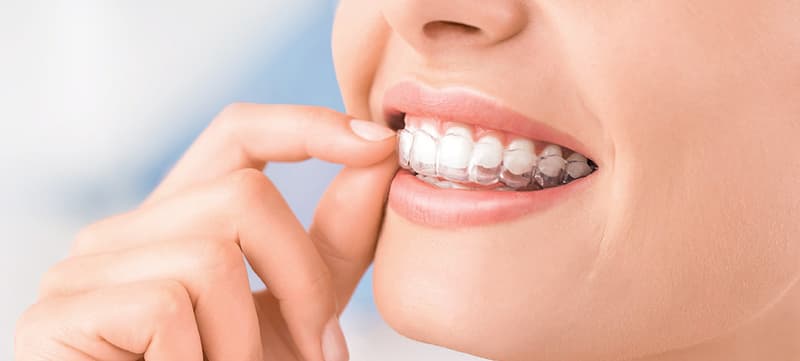 Our Invisalign Digital Smile Day Recap