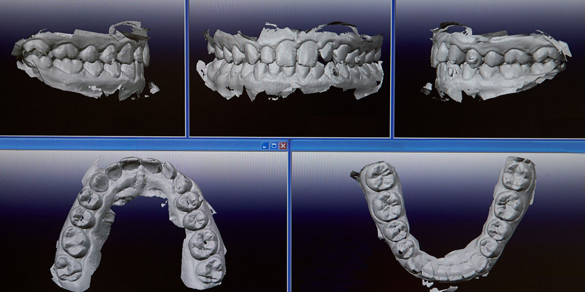 Revolutionizing Oral Health: Understanding the Role of Advanced Dental Technologies