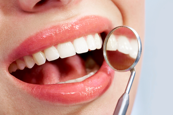 An Easy 5-Step Plan to Improve Your Dental Care